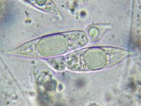 Anthostomella rubicola