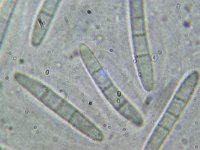 Crocicreas culmicola 2, Slijmspoorkelkje, Micro, Saxifraga-Lucien Rommelaars