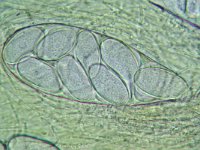 Ascobolus immersus