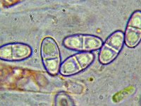 Hydropisphaera peziza 3, Ingedeukt meniezwammetje, Micro, Saxifraga-Lucien Rommelaars