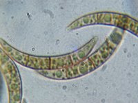 Melogramma campylosporum 1, Micro, Saxifraga-Lucien Rommelaars