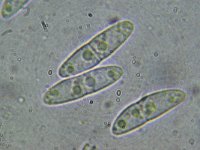 Nectriella dacrymycella 1, Micro, Saxifraga-Lucien Rommelaars