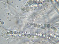 Trematosphaeria pertusa 1, Micro, Saxifraga-Lucien Rommelaars