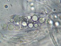 Trematosphaeria pertusa 3, Micro, Saxifraga-Lucien Rommelaars