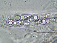 Trematosphaeria pertusa 4, Micro, Saxifraga-Lucien Rommelaars