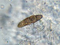 Trematosphaeria pertusa 5, Micro, Saxifraga-Lucien Rommelaars