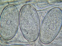 Ascobolus immersus 4, Slijmspoorspikkelschijfje, Micro, Saxifraga-Lucien Rommelaars