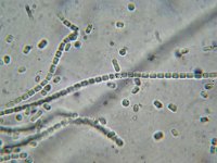 Cordyceps ophioglossoides 8, Zwarte truffelknotszwam, Micro, Saxifraga-Lucien Rommelaars