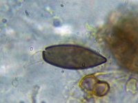 Anthostomella nitidula 2, Braamschoorsteentje, Micro, Saxifraga-Lucien Rommelaars