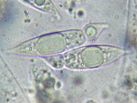 Anthostomella nitidula1, Braamschoorsteentje, Micro, Saxifraga-Lucien Rommelaars