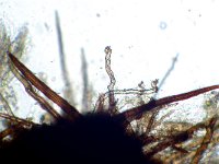 Echinosphaeria canescens 3, Bruingrijs ruigkogeltje,  Micro, Saxifraga-Lucien Rommelaars