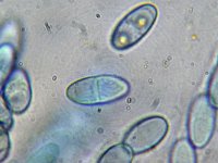 Hydropisphaera peziza 4, Ingedeukt meniezwammetje, Micro, Saxifraga-Lucien Rommelaars