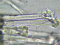 Incrucibulum capitatum 1, Kristalkopfranjekelkje, Micro, Saxifraga-Lucien Rommelaars