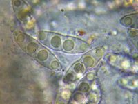 Nectria funicola 2, Micro, Saxifraga-Lucien Rommelaars