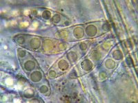 Nectria funicola 3, Micro, Saxifraga-Lucien Rommelaars