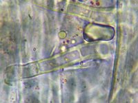 Nectria funicola 4, Micro, Saxifraga-Lucien Rommelaars