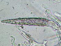 Peniophorella pubera 1, Fluwelig harskorstje, Micro, Saxifraga-Lucien Rommelaars