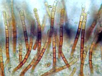 Trichopezizella nidulus 1, Gladharig franjekelkje,  Micro, Saxifraga-Lucien Rommelaars