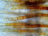 Trichopezizella nidulus 3, Gladharig franjekelkje,  Micro, Saxifraga-Lucien Rommelaars