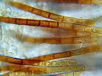 Trichopezizella nidulus 4, Gladharig franjekelkje,  Micro, Saxifraga-Lucien Rommelaars