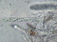 Trematosphaeria pertusa 2, Micro, Saxifraga-Lucien Rommelaars